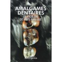 Amalgames dentaires